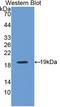 Complement Factor Properdin antibody, LS-C300146, Lifespan Biosciences, Western Blot image 