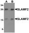 CD48 Molecule antibody, A03281, Boster Biological Technology, Western Blot image 