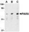 P21 (RAC1) Activated Kinase 6 antibody, A04903, Boster Biological Technology, Western Blot image 