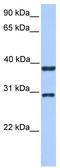 Kelch Domain Containing 1 antibody, TA337801, Origene, Western Blot image 