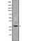 CCAAT Enhancer Binding Protein Delta antibody, abx149194, Abbexa, Western Blot image 