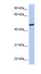 Chromosome 3 Open Reading Frame 62 antibody, NBP1-56807, Novus Biologicals, Western Blot image 