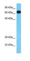 NADH:Ubiquinone Oxidoreductase Subunit A12 antibody, orb331380, Biorbyt, Western Blot image 