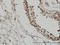 Tripartite Motif Containing 33 antibody, LS-C133759, Lifespan Biosciences, Immunohistochemistry frozen image 