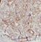 Erb-B2 Receptor Tyrosine Kinase 3 antibody, FNab02828, FineTest, Immunohistochemistry frozen image 