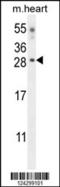 Claudin 6 antibody, 55-362, ProSci, Western Blot image 