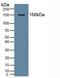 Nuclear Receptor Subfamily 3 Group C Member 2 antibody, MBS2026538, MyBioSource, Western Blot image 