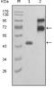 Fibulin 2 antibody, M07304, Boster Biological Technology, Western Blot image 