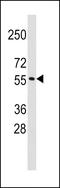 Tripartite Motif Containing 69 antibody, 61-414, ProSci, Western Blot image 