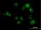 Tubulin Tyrosine Ligase Like 6 antibody, H00284076-B01P, Novus Biologicals, Immunofluorescence image 