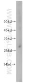 Telomerase RNA Component Interacting RNase antibody, 19420-1-AP, Proteintech Group, Western Blot image 