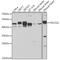 Programmed Cell Death 2 Like antibody, GTX32776, GeneTex, Western Blot image 
