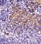 ATP Binding Cassette Subfamily B Member 5 antibody, NBP1-77687, Novus Biologicals, Immunohistochemistry paraffin image 