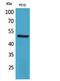 Corticotropin Releasing Hormone Receptor 1 antibody, STJ96855, St John