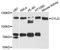 CYLD Lysine 63 Deubiquitinase antibody, A3821, ABclonal Technology, Western Blot image 