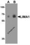 LIM Domain And Actin Binding 1 antibody, 8053, ProSci, Western Blot image 