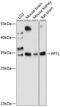 Palmitoyl-Protein Thioesterase 1 antibody, 15-717, ProSci, Western Blot image 