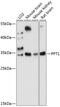 Palmitoyl-protein thioesterase 1 antibody, 15-717, ProSci, Western Blot image 