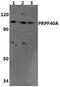 Pre-MRNA Processing Factor 40 Homolog A antibody, PA5-75938, Invitrogen Antibodies, Western Blot image 