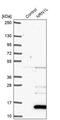 Neuritin 1 Like antibody, PA5-59713, Invitrogen Antibodies, Western Blot image 