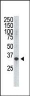 Vascular Endothelial Growth Factor D antibody, MA5-11120, Invitrogen Antibodies, Western Blot image 