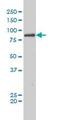 Argonaute RISC Catalytic Component 2 antibody, ab57113, Abcam, Western Blot image 