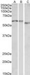 Adrenoceptor Alpha 1B antibody, LS-C186439, Lifespan Biosciences, Western Blot image 