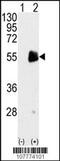 Protein Arginine Methyltransferase 7 antibody, 55-040, ProSci, Western Blot image 