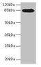 Regulator Of G Protein Signaling 20 antibody, LS-C370025, Lifespan Biosciences, Western Blot image 