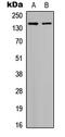 Histone Deacetylase 6 antibody, LS-C356091, Lifespan Biosciences, Western Blot image 