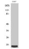 Eukaryotic Translation Initiation Factor 4E Binding Protein 1 antibody, STJ91385, St John