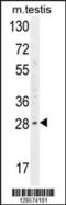 YdjC Chitooligosaccharide Deacetylase Homolog antibody, 55-305, ProSci, Western Blot image 