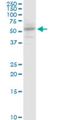 Solute Carrier Family 13 Member 5 antibody, H00284111-M06, Novus Biologicals, Western Blot image 