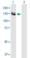 Transient Receptor Potential Cation Channel Subfamily C Member 5 antibody, H00007224-B01P, Novus Biologicals, Western Blot image 