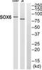 SRY-Box 6 antibody, TA315590, Origene, Western Blot image 