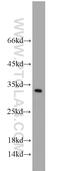 Synaptogyrin 1 antibody, 10432-1-AP, Proteintech Group, Western Blot image 