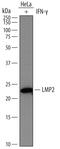 Proteasome Subunit Beta 9 antibody, MAB7709, R&D Systems, Western Blot image 