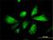 Citrin antibody, H00010165-M01, Novus Biologicals, Immunocytochemistry image 