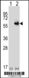 Delta-1-pyrroline-5-carboxylate dehydrogenase, mitochondrial antibody, 63-261, ProSci, Western Blot image 