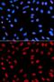 Interferon Gamma Inducible Protein 16 antibody, GTX54298, GeneTex, Immunocytochemistry image 