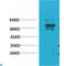 Potassium Voltage-Gated Channel Subfamily A Member 5 antibody, LS-C813646, Lifespan Biosciences, Western Blot image 