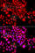 Activating Signal Cointegrator 1 Complex Subunit 3 antibody, A7960, ABclonal Technology, Immunofluorescence image 