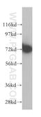 Arginyl Aminopeptidase antibody, 14764-1-AP, Proteintech Group, Western Blot image 