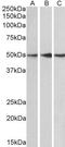 Protein Phosphatase 2 Regulatory Subunit B'Epsilon antibody, GTX89983, GeneTex, Western Blot image 