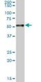 Retinoic Acid Receptor Alpha antibody, H00005914-M09, Novus Biologicals, Western Blot image 