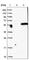 Dihydrolipoamide Branched Chain Transacylase E2 antibody, HPA026481, Atlas Antibodies, Western Blot image 