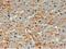 Ubiquitin Conjugating Enzyme E2 O antibody, GTX13728, GeneTex, Immunohistochemistry paraffin image 