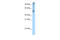 65 kDa eukaryotic translation initiation factor 2A antibody, ARP41041_T100, Aviva Systems Biology, Western Blot image 