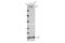 ATM Serine/Threonine Kinase antibody, 92356S, Cell Signaling Technology, Western Blot image 