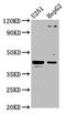 Glycoprotein-N-acetylgalactosamine 3-beta-galactosyltransferase 1 antibody, LS-C673963, Lifespan Biosciences, Western Blot image 